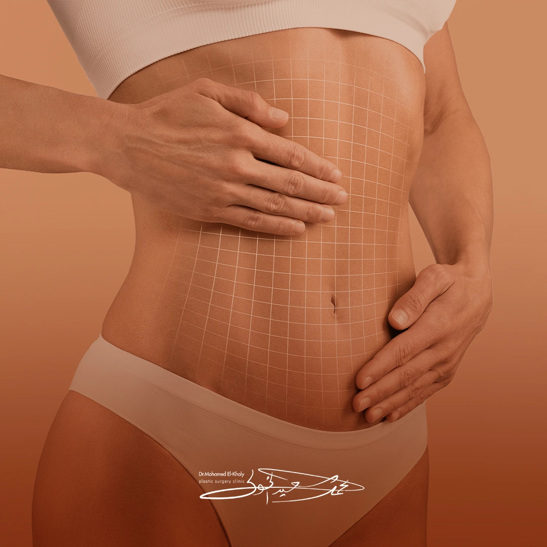 Body Contouring plastic surgery procedure by Dr. Mohamed Elkholy - عملية Body Contouring جراحة تجميل مع دكتور محمد الخولي